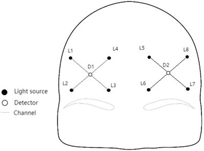 Experimental study of transcranial pulsed current stimulation on relieving athlete’s mental fatigue